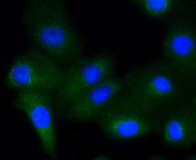 A549 cells were stained with Glycogen synthase 1(S641) (10C1) Monoclonal Antibody (bsm-52159R) at 1:200 followed by secondary antibody incubation, DAPI staining of the nuclei and detection.