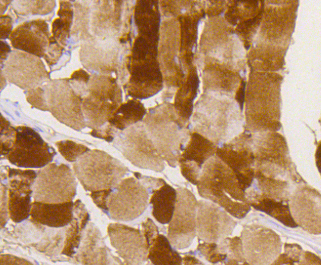 Paraformaldehyde-fixed, paraffin embedded mouse skeletal muscle; Antigen retrieval by boiling in sodium citrate buffer (pH6) for 15min; Block endogenous peroxidase by 3% hydrogen peroxide for 30 minutes; Blocking buffer at 37°C for 20min; Antibody incubation with Glycogen synthase 1(S641) (10C1) Monoclonal Antibody (bsm-52159R) at 1:50 overnight at 4°C, followed by a conjugated secondary and DAB staining.