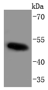 Lane 1: K562 lysates probed with c-Myc(T58+S62) (2B11) Monoclonal Antibody (bsm-52145R) at 1:1000 overnight at 4˚C. Followed by a conjugated secondary antibody.