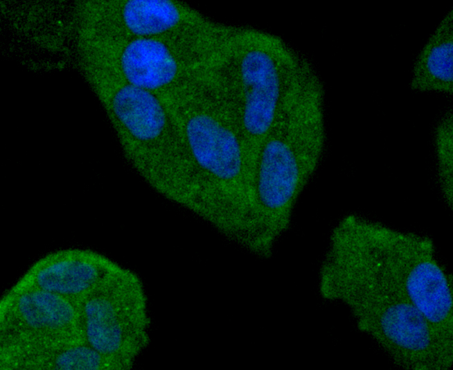 Hela cells were stained with Smad4 (3A1) Monoclonal Antibody (bsm-52225R)  at  [1:200] incubated overnight at 4C followed by secondary antibody incubation, DAPI staining of the nuclei and detection.
