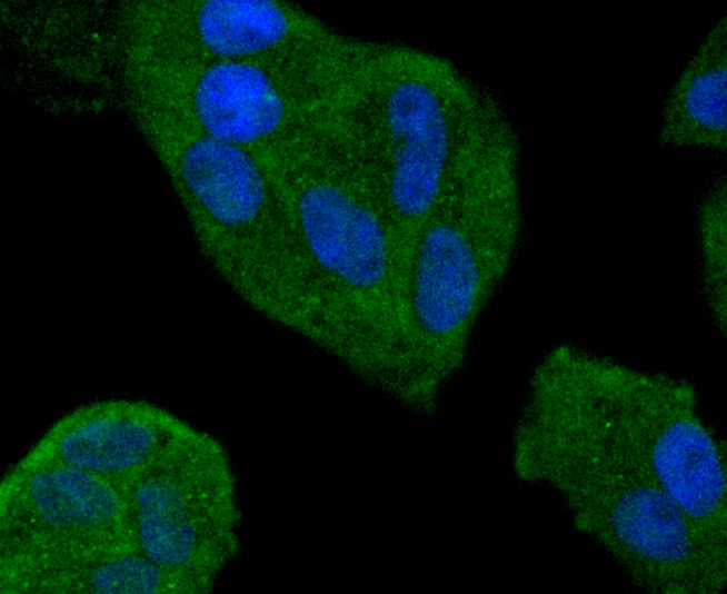 Hela cells were stained with Smad4 (3A1) Monoclonal Antibody (bsm-52225R) at [1:200] incubated overnight at 4C followed by secondary antibody incubation, DAPI staining of the nuclei and detection.