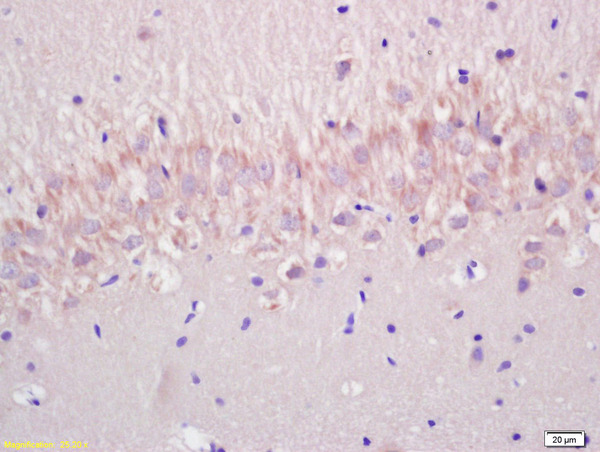 Formalin-fixed and paraffin embedded rat brain labeled with Anti-P53(wt-p53) Polyclonal Antibody, Unconjugated (bs-2090R) at 1:200 followed by conjugation to the secondary antibody and DAB staining.