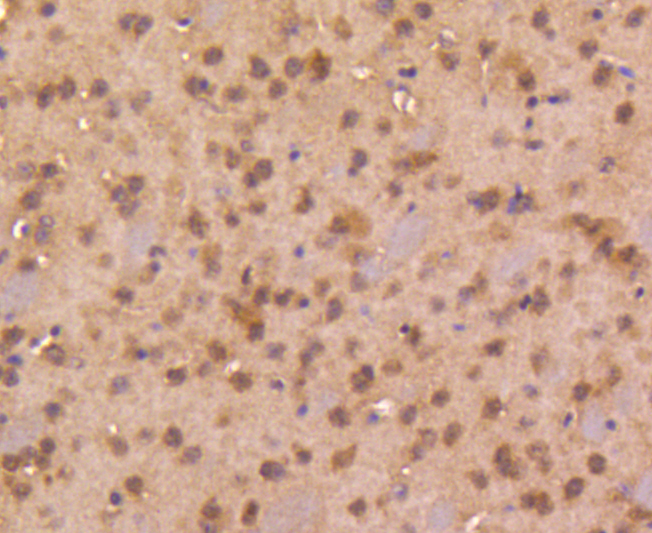 Paraformaldehyde-fixed, paraffin embedded mouse brain; Antigen retrieval by boiling in sodium citrate buffer (pH6) for 15min; Block endogenous peroxidase by 3% hydrogen peroxide for 30 minutes; Blocking buffer at 37°C for 20min; Antibody incubation with Smad4 (3A1) Monoclonal Antibody, (bsm-52225R) at 1:50 overnight at 4°C, followed by a conjugated secondary and DAB staining.