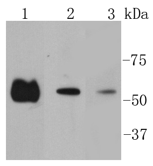 Lane 1: Hela lysates; Lane 2:A431 lysates; Lane 3: PC12 lysates probed with Smad2 (9A3) Monoclonal Antibody (bsm-52223R) at 1:1000 overnight at 4˚C. Followed by a conjugated secondary antibody.