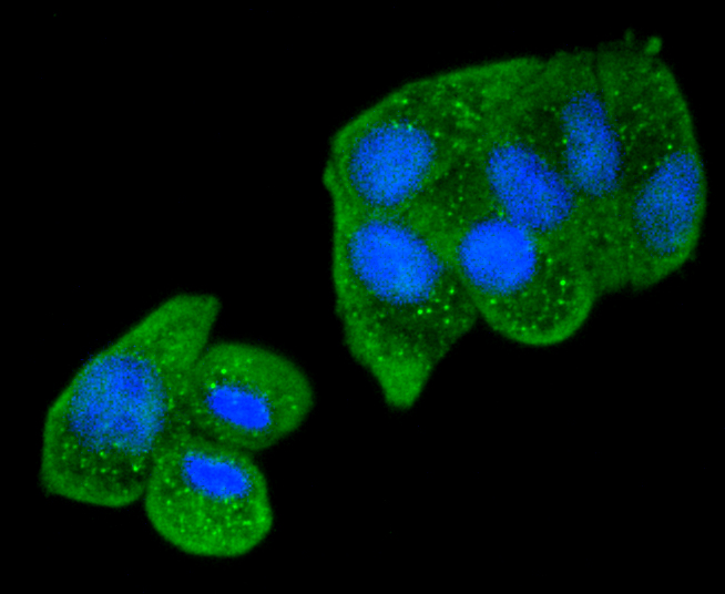 Hela cells were stained with Smad2 (9A3) Monoclonal Antibody (bsm-52223R)  at  [1:200] incubated for overnight at 4C followed by secondary antibody incubation, DAPI staining of the nuclei and detection.