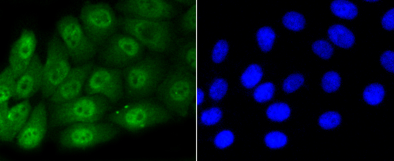 HepG2 cells were stained with Smad5(S463\/465) (1B8) Monoclonal Antibody (bsm-52206R)  at  [1:200] incubated overnight at 4C, followed by secondary antibody incubation, DAPI staining of the nuclei and detection.