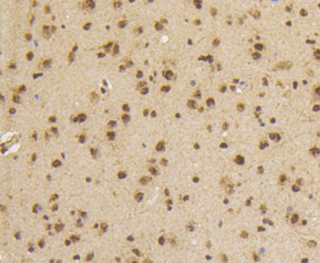 Paraformaldehyde-fixed, paraffin embedded mouse brain; Antigen retrieval by boiling in sodium citrate buffer (pH6) for 15min; Block endogenous peroxidase by 3% hydrogen peroxide for 30 minutes;  Blocking buffer at 37\u00b0C for 20min; Antibody incubation with Smad5(S463\/465) (1B8) Monoclonal Antibody (bsm-52206R) at 1:50 overnight at 4\u00b0C, followed by a conjugated secondary and DAB staining.