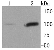 Lane 1: NIH\/3T3 lysates; Lane 2: Hela lysates probed with STAT6 (9A7) Monoclonal Antibody (bsm-52239R) at 1:1000 overnight at 4˚C. Followed by a conjugated secondary antibody.