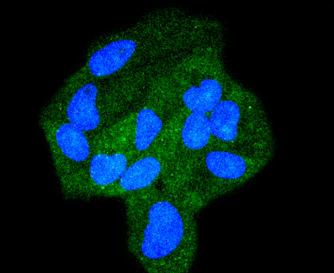 Hela cells were fixed in paraformaldehyde, permeabilized with 0.25% Triton X100/PBS and stained with STAT6 (9A7) Monoclonal Antibody (bsm-52239R) at 1:200 and incubated overnight at 4C, followed by secondary antibody incubation, DAPI staining of the nuclei and detection.
