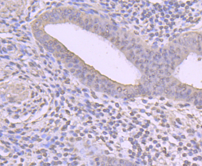 Paraformaldehyde-fixed, paraffin embedded human uterus _x000D_ tissue; Antigen retrieval by boiling in sodium citrate buffer (pH6) for 15min; Block endogenous peroxidase by 3% hydrogen peroxide for 30 minutes; Blocking buffer at 37°C for 20min; Antibody incubation with Cyclin A2 (2E9) Monoclonal Antibody (bsm-52043M) at 1:50 overnight at 4°C, followed by a conjugated secondary and DAB staining.