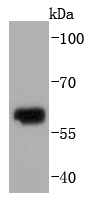 Human skin ysates probed with Collagen X (1H8) Monoclonal Antibody (bsm-52040R) at 1:1000 overnight at 4˚C. Followed by a conjugated secondary antibody .