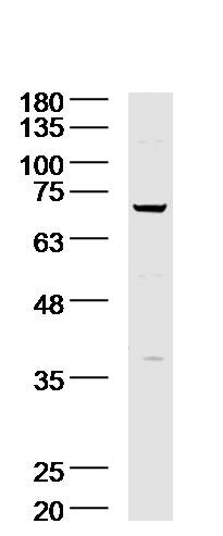Lane 1: A431 lysates probed with Acid sphingomyelinase Antibody (bs-6318R) at 1:300 overnight at 4˚C. Followed by a conjugated secondary antibody at 1:5000 for 90 min at 37˚C. Lane 1: A431 lysates probed with Acid sphingomyelinase Antibody (bs-6318R) at 1:300 overnight at 4˚C. Followed by a conjugated secondary antibody at 1:5000 for 90 min at 37˚C.