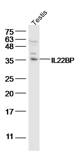 Lane 1: Rat testis lysates; probed with IL-22BP/IL22RA2 Polyclonal Antibody, unconjugated (bs-2625R) at 1:300 overnight at 4°C followed by a conjugated secondary antibody for 60 minutes at 37°C.