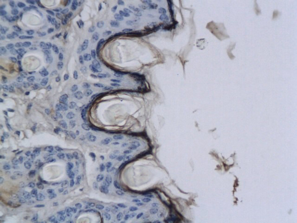 Formalin-fixed and paraffin embedded rat skin labeled with Anti-CNR2/CB2 Polyclonal Antibody, Unconjugated (bs-2377R) at 1:200 followed by conjugation to the secondary antibody and DAB staining.