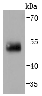 Human lung lysates probed with IRF2 (5F2) Monoclonal Antibody (bsm-52115R) at 1:1000 overnight at 4˚C. Followed by a conjugated secondary antibody.