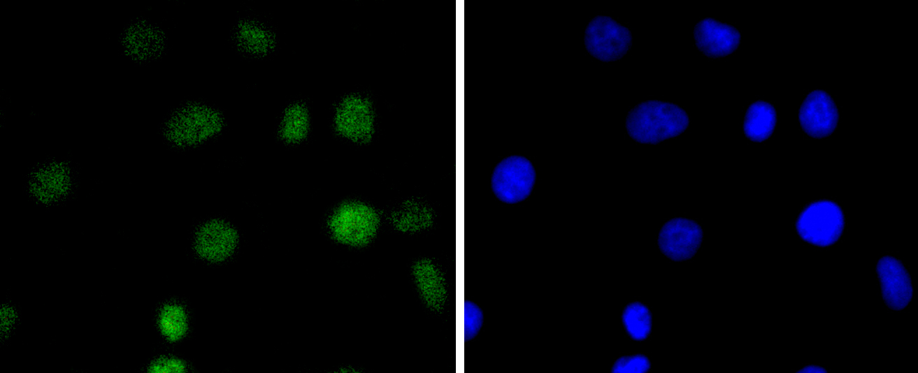 A549 cells were stained with IRF2 (5F2) Monoclonal Antibody (bsm-52115R) at [1:200] incubated overnight at 4C, followed by secondary antibody incubation, DAPI staining of the nuclei and detection.