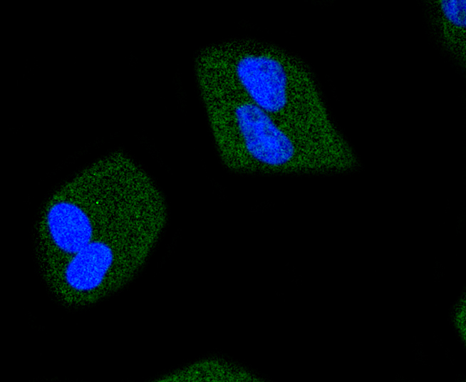 HeLa cells were stained with JAK2(Y1007+Y1008) (6E5 ) Monoclonal Antibody (bsm-52171R) at 1:200 dilution, incubated overnight at 4C, followed by secondary antibody incubation, DAPI staining of the nuclei and detection.