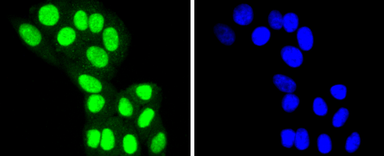 HepG2 cells were stained with HDAC8 (4C3) Monoclonal Antibody (bsm-52088R) at [1:200] incubated overnight at 4C, followed by secondary antibody incubation, DAPI staining of the nuclei and detection.