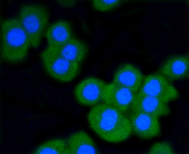 CRC cells were fixed in paraformaldehyde, permeabilized with 0.25% Triton X100/PBS and stained with Stat3 (6G5) Monoclonal Antibody (bsm-52235R) at 1:200 and incubated overnight at 4C, followed by secondary antibody incubation, DAPI staining of the nuclei and detection.