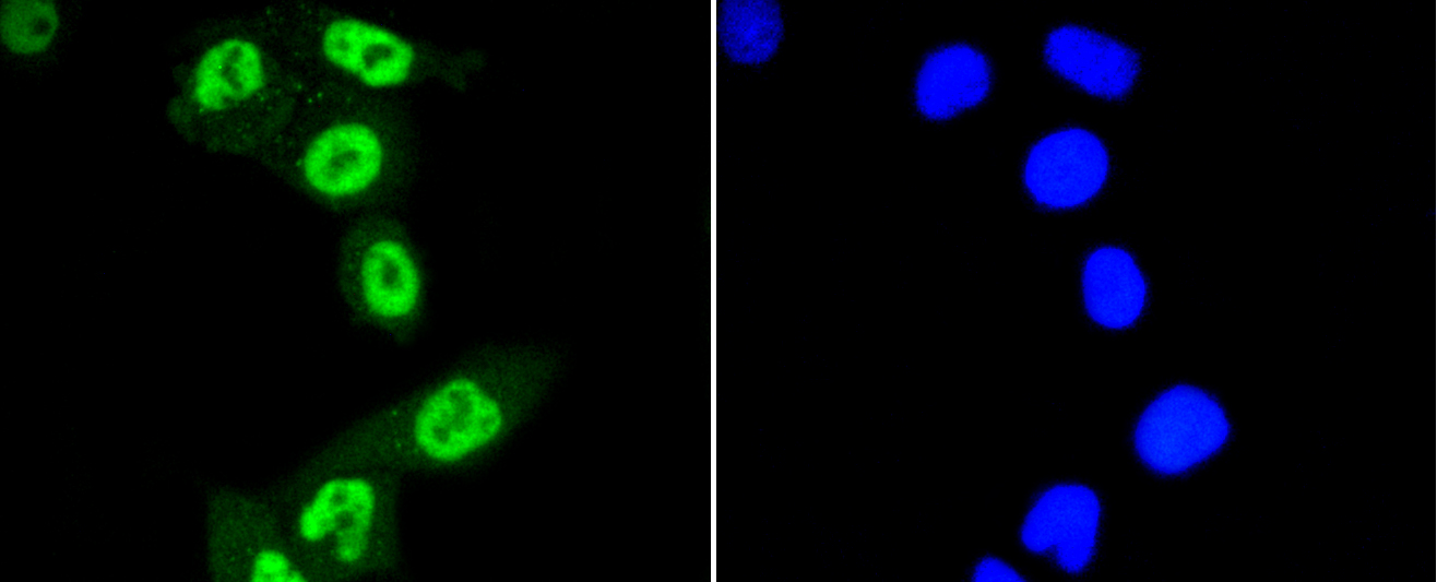 HeLa cells were fixed in paraformaldehyde, permeabilized with 0.25% Triton X100\/PBS and stained with STAT3(S727) (4G1 ) Monoclonal Antibody (bsm-52210R) at 1:200 and incubated overnight at 4C, followed by secondary antibody incubation, DAPI staining of the nuclei and detection.