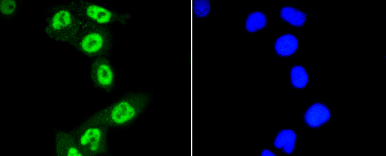 HeLa cells were fixed in paraformaldehyde, permeabilized with 0.25% Triton X100/PBS and stained with STAT3(S727) (4G1 ) Monoclonal Antibody (bsm-52210R) at 1:200 and incubated overnight at 4C, followed by secondary antibody incubation, DAPI staining of the nuclei and detection.