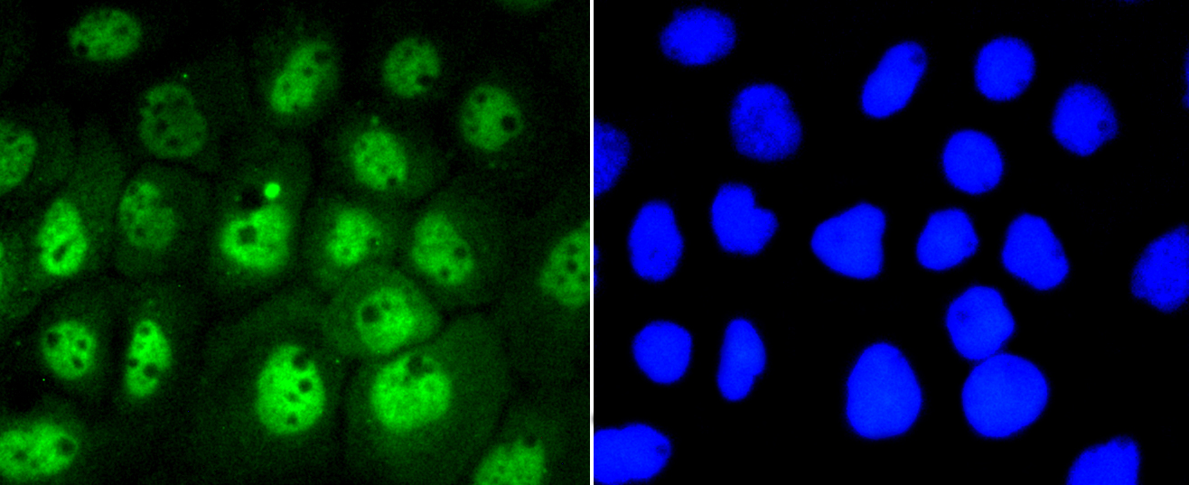 A431 cells were fixed in paraformaldehyde, permeabilized with 0.25% Triton X100/PBS and stained with STAT3(S727) (4G1 ) Monoclonal Antibody (bsm-52210R) at 1:200 and incubated overnight at 4C, followed by secondary antibody incubation, DAPI staining of the nuclei and detection.