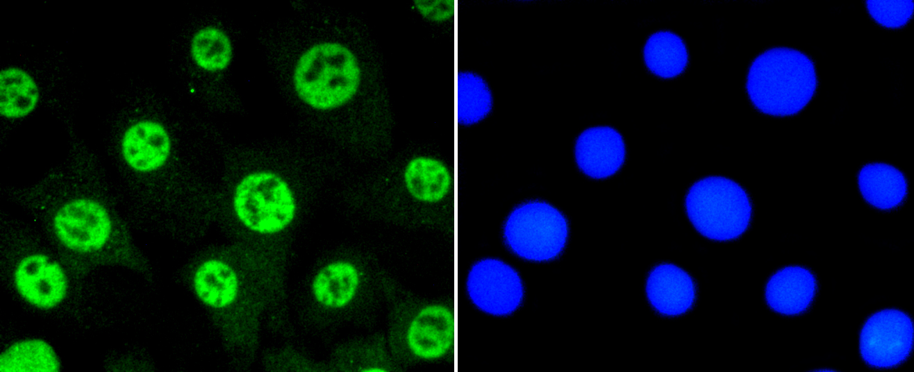 NIH\/3T3 cells were fixed in paraformaldehyde, permeabilized with 0.25% Triton X100\/PBS and stained with STAT3(S727) (4G1 ) Monoclonal Antibody (bsm-52210R) at 1:200 and incubated overnight at 4C, followed by secondary antibody incubation, DAPI staining of the nuclei and detection.