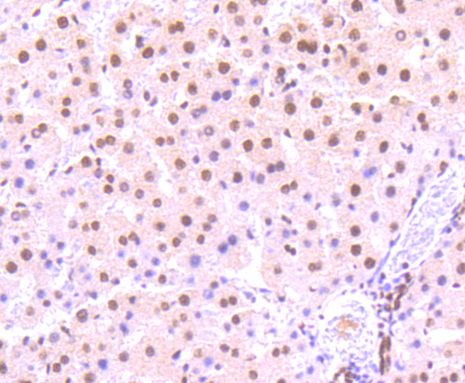 Paraformaldehyde-fixed, paraffin embedded rat liver; Antigen retrieval by boiling in sodium citrate buffer (pH6) for 15min; Block endogenous peroxidase by 3% hydrogen peroxide for 30 minutes; Blocking buffer at 37°C for 20min; Antibody incubation with STAT3(S727) (4G1) Monoclonal Antibody (bsm-52210R) at 1:50 overnight at 4°C, followed by a conjugated secondary and DAB staining.