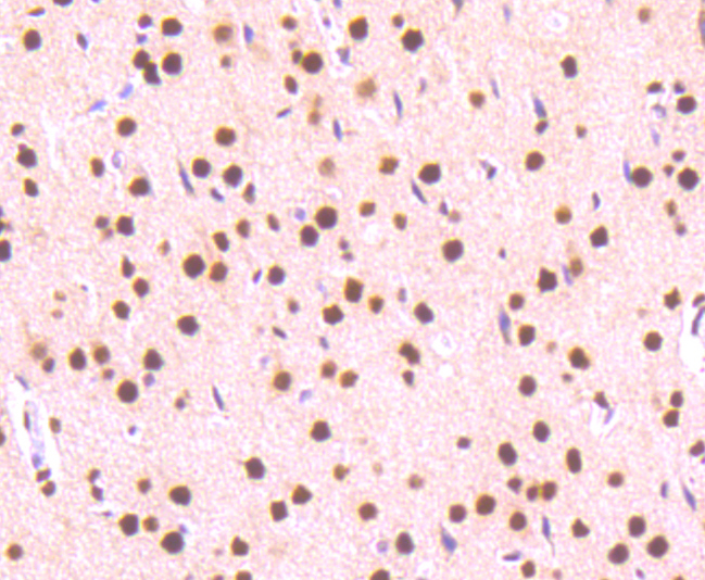 Paraformaldehyde-fixed, paraffin embedded rat liver; Antigen retrieval by boiling in sodium citrate buffer (pH6) for 15min; Block endogenous peroxidase by 3% hydrogen peroxide for 30 minutes; Blocking buffer at 37°C for 20min; Antibody incubation with STAT3(S727) (4G1) Monoclonal Antibody (bsm-52210R) at 1:50 overnight at 4°C, followed by a conjugated secondary and DAB staining.