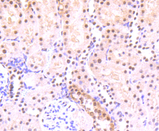 Paraformaldehyde-fixed, paraffin embedded rat Kidney; Antigen retrieval by boiling in sodium citrate buffer (pH6) for 15min; Block endogenous peroxidase by 3% hydrogen peroxide for 30 minutes; Blocking buffer at 37°C for 20min; Antibody incubation with STAT3(S727) (4G1) Monoclonal Antibody (bsm-52210R) at 1:50 overnight at 4°C, followed by a conjugated secondary and DAB staining.