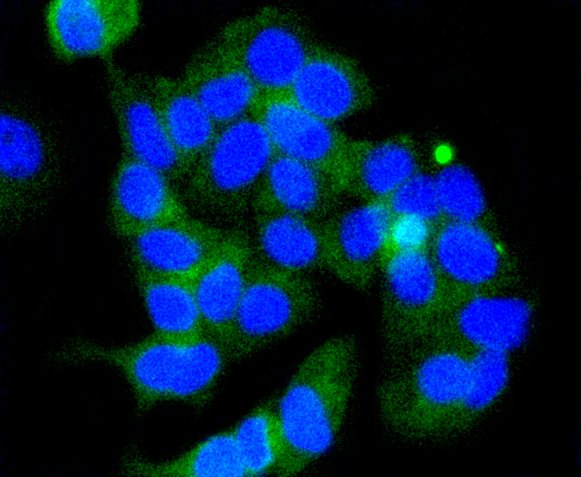 MCF-7 cells were fixed in paraformaldehyde, permeabilized with 0.25% Triton X100\/PBS and stained with GSK3 beta(Ser 9) (7A4) Monoclonal Antibody (bsm-52160R) at 1:200 and incubated overnight at 4C, followed by secondary antibody incubation, DAPI staining of the nuclei and detection.