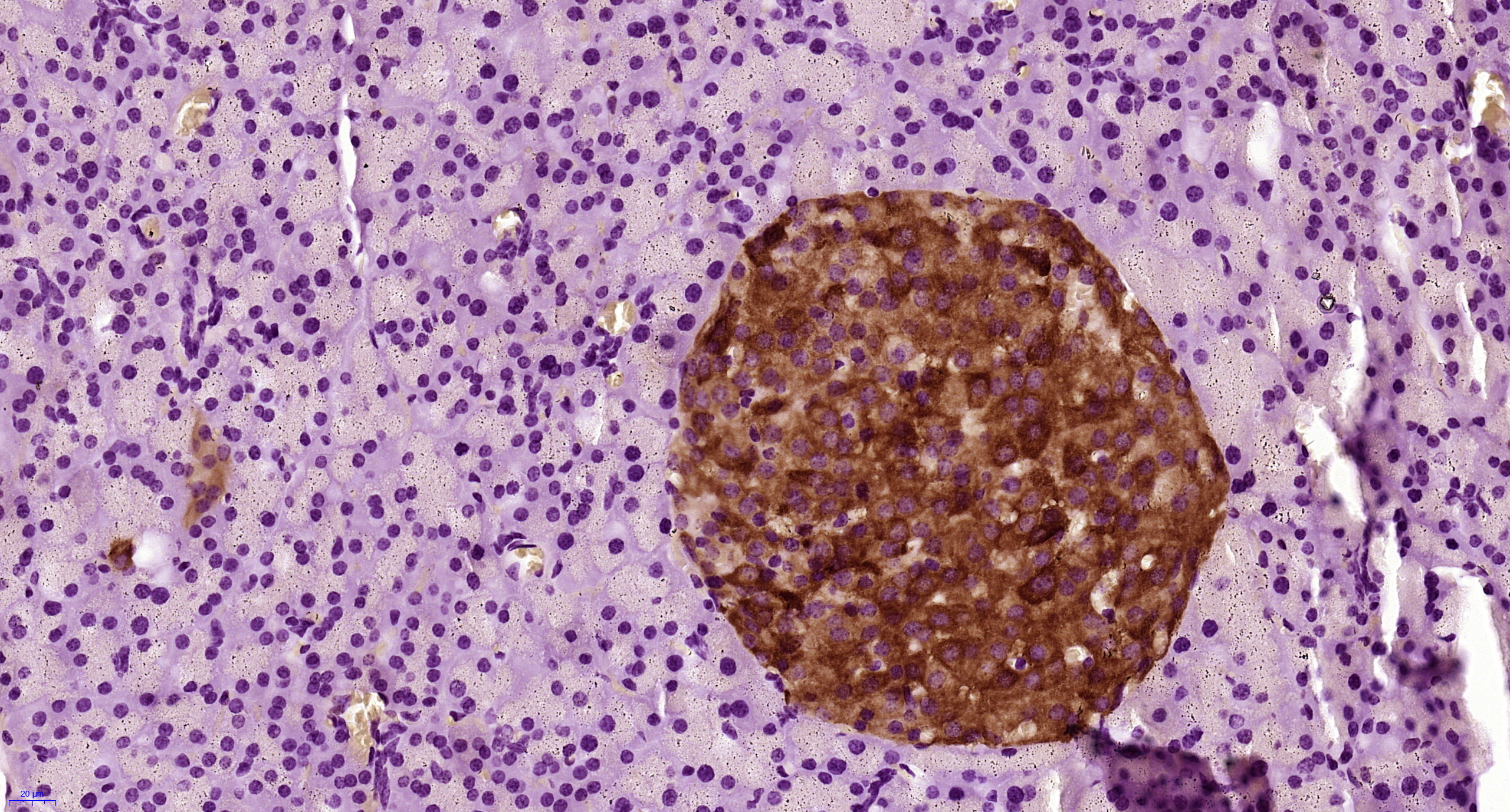 Paraformaldehyde-fixed, paraffin embedded mouse pancreas; Antigen retrieval by boiling in sodium citrate buffer (pH6) for 15min; Block endogenous peroxidase by 3% hydrogen peroxide for 30 minutes; Blocking buffer (normal goat serum) at 37°C for 20min; Antibody incubation with PRLR Polyclonal Antibody (bs-6445R) at 1:400 overnight at 4°C, followed by a conjugated secondary and DAB staining.