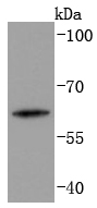 Human skin lysates probed with Cytokeratin 2e (2F7) Monoclonal Antibody (bsm-52061R) at 1:1000 overnight at 4˚C. Followed by a conjugated secondary antibody .