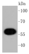 MCF-7 lysates probed with AKT1 (11F2) Monoclonal Antibody (bsm-52010R) at 1:1000 overnight at 4˚C. Followed by a conjugated secondary antibody.