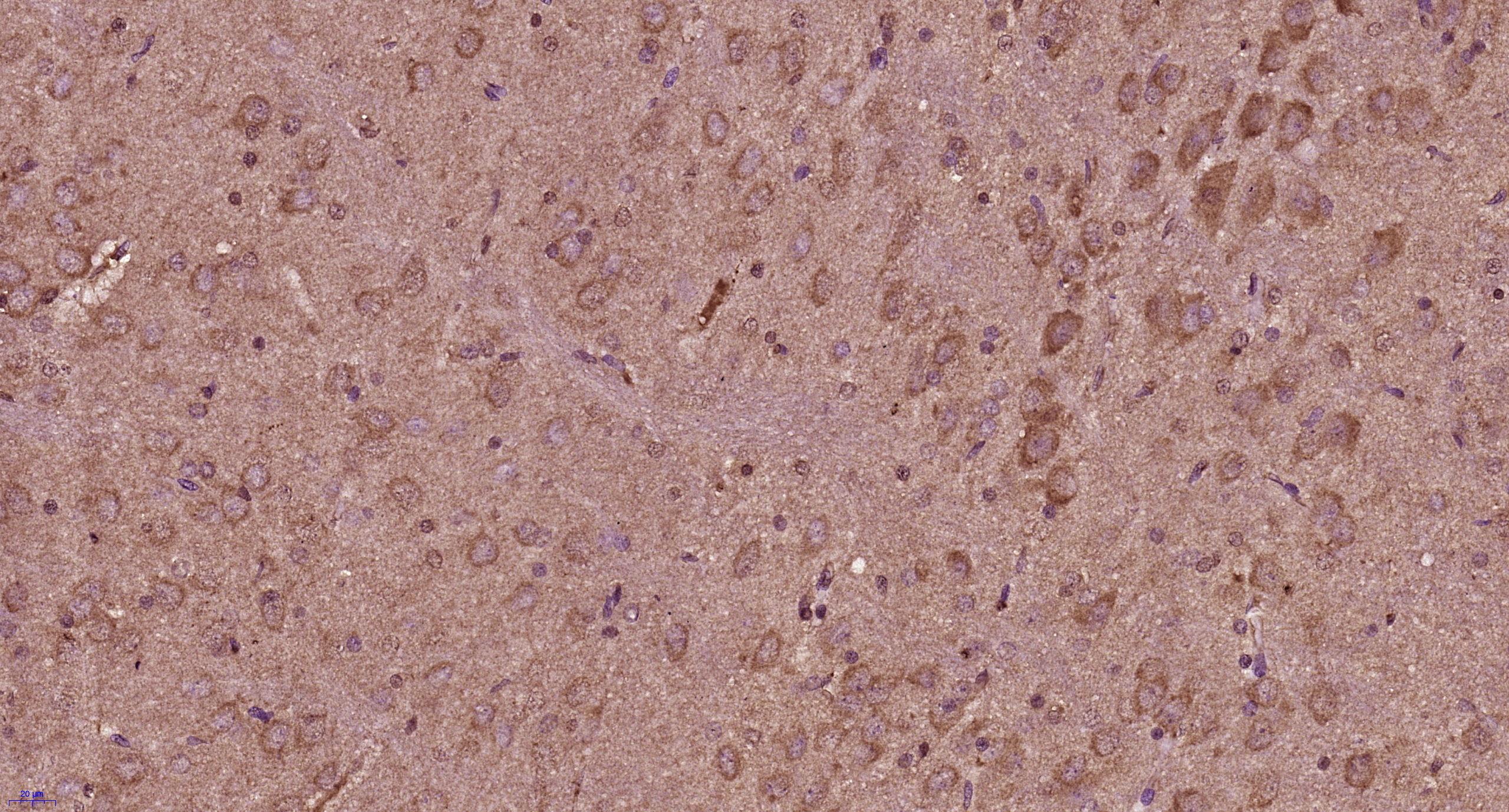 Paraformaldehyde-fixed, paraffin embedded rat brain; Antigen retrieval by boiling in sodium citrate buffer (pH6) for 15min; Block endogenous peroxidase by 3% hydrogen peroxide for 30 minutes; Blocking buffer (normal goat serum) at 37°C for 20min; Antibody incubation with Progestin Receptor Beta/MPRB Antibody(bs-11410R) at 1:400 overnight at 4°C, followed by a conjugated secondary and DAB staining. Paraformaldehyde-fixed, paraffin embedded rat brain; Antigen retrieval by boiling in sodium citrate buffer (pH6) for 15min; Block endogenous peroxidase by 3% hydrogen peroxide for 30 minutes; Blocking buffer (normal goat serum) at 37°C for 20min; Antibody incubation with Progestin Receptor Beta/MPRB Antibody(bs-11410R) at 1:400 overnight at 4°C, followed by a conjugated secondary and DAB staining.