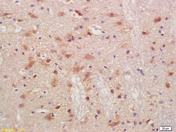 Formalin-fixed and paraffin embedded rat brain labeled with Anti-PMP2 Polyclonal Antibody, Unconjugated (bs-2032R) at 1:200, followed by conjugation to the secondary antibody and DAB staining