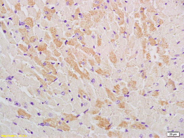 Formalin-fixed and paraffin embedded mouse heart labeled with Rabbit Anti-GLUT12 Polyclonal Antibody, Unconjugated (bs-2540R) at 1:200, followed by conjugation to the secondary antibody and DAB staining\n Formalin-fixed and paraffin embedded mouse heart labeled with Rabbit Anti-GLUT12 Polyclonal Antibody, Unconjugated (bs-2540R) at 1:200, followed by conjugation to the secondary antibody and DAB staining\n