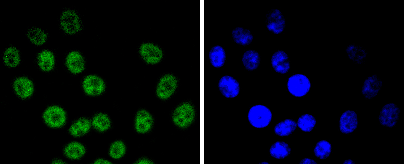 HepG2 cells were stained with Cyclin E1 (4H7) Monoclonal Antibody (bsm-52048R) at [1:200] incubated overnight at 4C, followed by secondary antibody incubation, DAPI staining of the nuclei and detection.