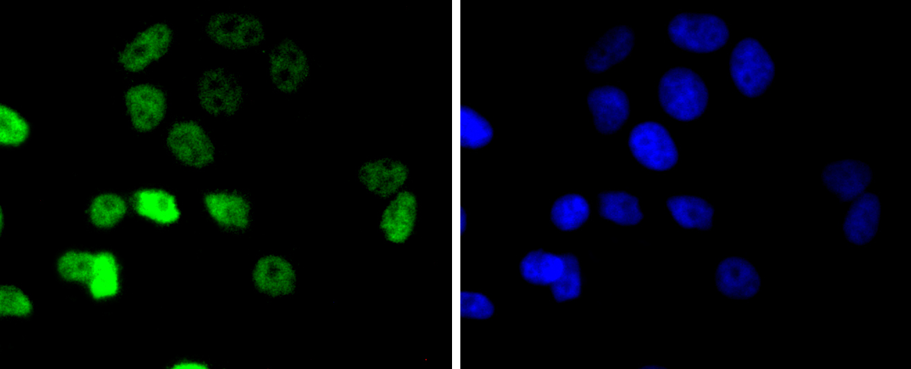 MCF-7 cells were stained with Cyclin E1 (4H7) Monoclonal Antibody (bsm-52048R) at [1:200] incubated overnight at 4C, followed by secondary antibody incubation, DAPI staining of the nuclei and detection.