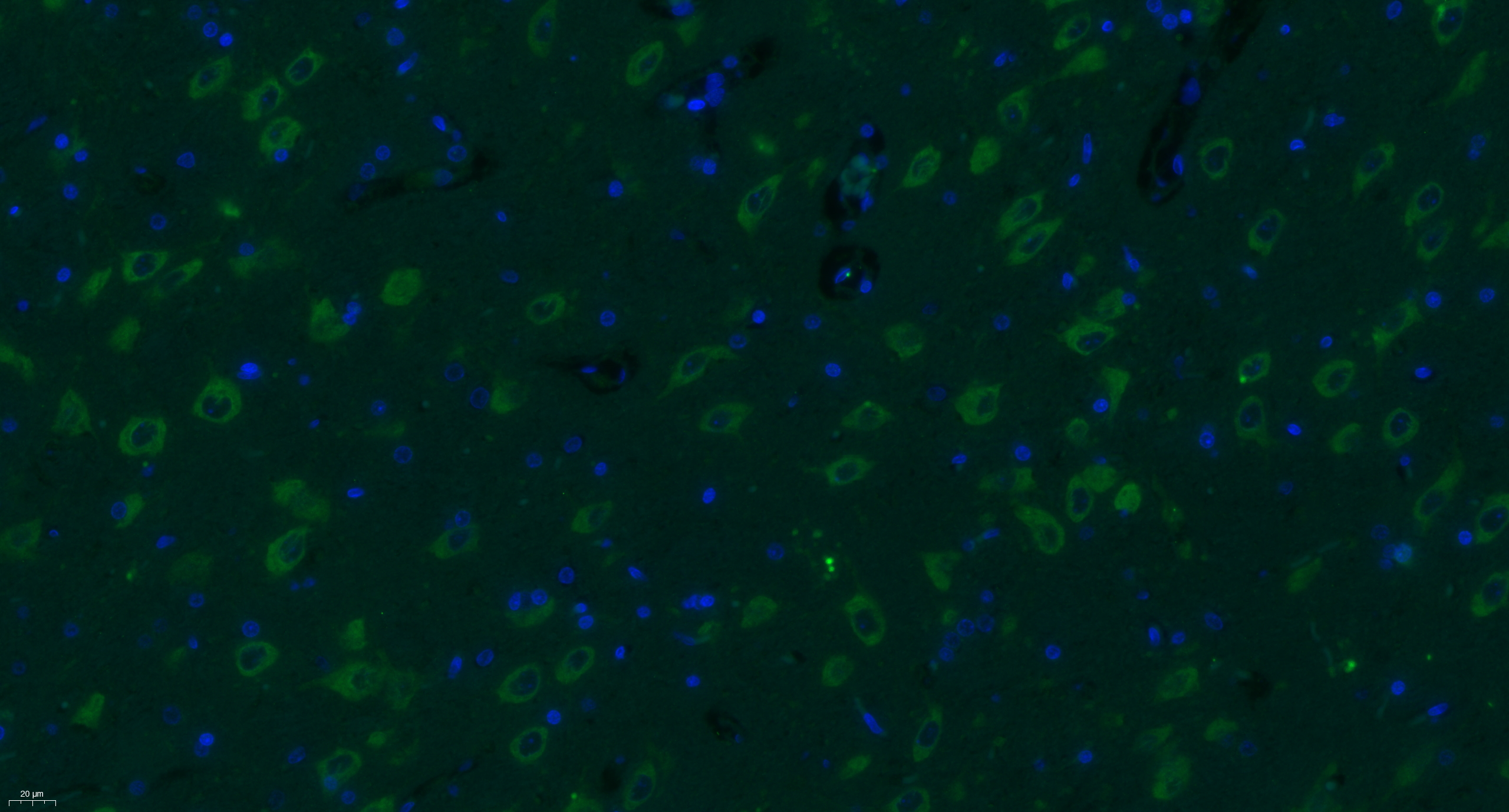 Paraformaldehyde-fixed, paraffin embedded rat brain; Antigen retrieval by boiling in sodium citrate buffer (pH6) for 15min; Block endogenous peroxidase by 3% hydrogen peroxide for 30 minutes; Blocking buffer (normal goat serum) at 37°C for 20min; Antibody incubation with Progestin Receptor Beta/MPRB Antibody (bs-11410R) at 1:400 overnight at 4°C, followed by a conjugated secondary Goat Anti-Rabbit IgG antibody (bs-0295G-FITC) for 90 minutes, and DAPI for nuclei staining. Paraformaldehyde-fixed, paraffin embedded rat brain; Antigen retrieval by boiling in sodium citrate buffer (pH6) for 15min; Block endogenous peroxidase by 3% hydrogen peroxide for 30 minutes; Blocking buffer (normal goat serum) at 37°C for 20min; Antibody incubation with Progestin Receptor Beta/MPRB Antibody (bs-11410R) at 1:400 overnight at 4°C, followed by a conjugated secondary Goat Anti-Rabbit IgG antibody (bs-0295G-FITC) for 90 minutes, and DAPI for nuclei staining.