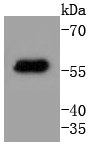 293T cell lysates probed with Cytokeratin 4 (2F9) Monoclonal Antibody (bsm-52062R) at 1:1000 overnight at 4˚C. Followed by a conjugated secondary antibody.
