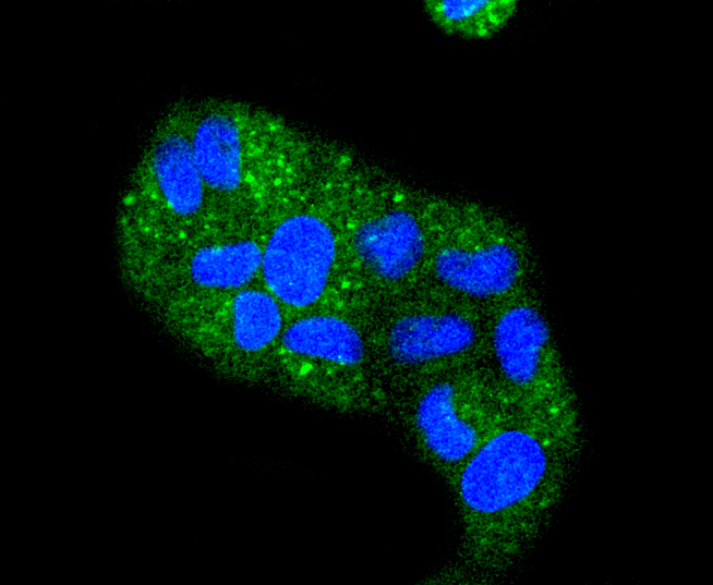 HeLa cells were stained with Cytokeratin 4 (2F9) Monoclonal Antibody (bsm-52062R) at [1:200] incubated overnight at 4C, followed by secondary antibody incubation, DAPI staining of the nuclei and detection.