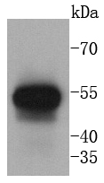 Human lung lysates probed with Cytokeratin 13 (5A3) Monoclonal Antibody(bsm-52053R) at 1:1000 overnight at 4˚C. Followed by a conjugated secondary antibody.