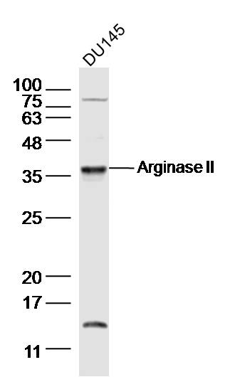 DU145 Cell lysates; probed with Arginase II Polyclonal Antibody, unconjugated (bs-11397R) at 1:300 overnight at 4°C followed by a conjugated secondary antibody for 60 minutes at 37°C.