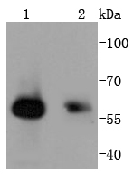 Lane 1: Human skeletal muscle; Lane 2: Hela; probed with HDAC2 (3B7) Monoclonal Antibody (bsm-52082R) at 1:1000 overnight at 4˚C. Followed by a conjugated secondary antibody.