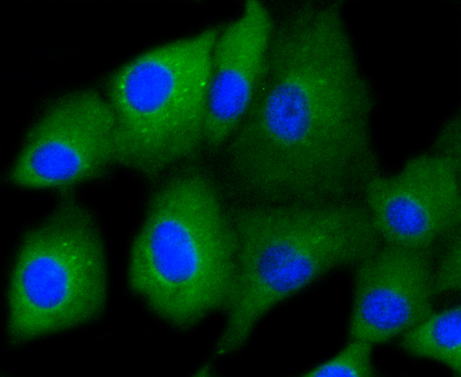 A549 cells were fixed in paraformaldehyde, permeabilized with 0.25% Triton X100\/PBS and stained with Cytokeratin 7 (6E6) Monoclonal Antibody (bsm-52065R) at 1:200 and incubated overnight at 4C, followed by secondary antibody incubation, DAPI staining of the nuclei and detection.
