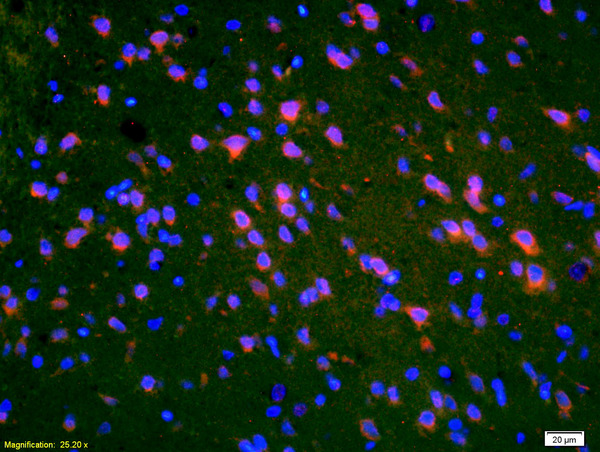 Formalin-fixed and paraffin-embedded rat brain labeled with Anti-PMP2 Polyclonal Antibody, Unconjugated(bs-2032R) 1:200, overnight at 4°C, The secondary antibody was Goat Anti-Rabbit IgG, Cy3 conjugated(bs-0295G-Cy3)used at 1:200 dilution for 40 minutes at 37°C. Formalin-fixed and paraffin-embedded rat brain labeled with Anti-PMP2 Polyclonal Antibody, Unconjugated(bs-2032R) 1:200, overnight at 4°C, The secondary antibody was Goat Anti-Rabbit IgG, Cy3 conjugated(bs-0295G-Cy3)used at 1:200 dilution for 40 minutes at 37°C.
