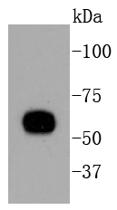 HeLa lysates; probed with Cytokeratin 10 (1D8) Monoclonal Antibody (bsm-52052R) at 1:1000 overnight at 4˚C. Followed by a conjugated secondary antibody.