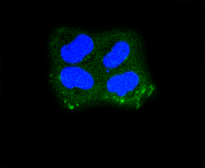 HeLa cells were fixed in paraformaldehyde, permeabilized with 0.25% Triton X100\/PBS and stained with Cytokeratin 10 (1D8) Monoclonal Antibody (bsm-52052R) at 1:200 and incubated overnight at 4C, followed by secondary antibody incubation, DAPI staining of the nuclei and detection.
