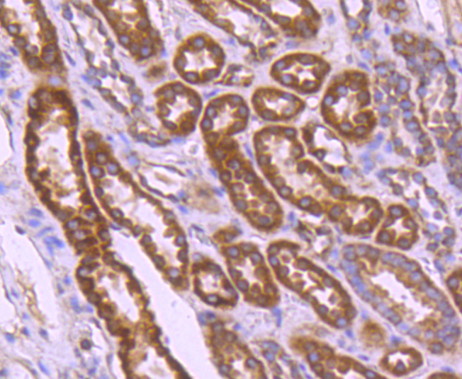 Paraformaldehyde-fixed, paraffin embedded human kidney; Antigen retrieval by boiling in sodium citrate buffer (pH6) for 15min; Block endogenous peroxidase by 3% hydrogen peroxide for 30 minutes; Blocking buffer at 37°C for 20min; Antibody incubation with BCL2A1 (3E4) Monoclonal Antibody (bsm-52023R) at 1:50 overnight at 4°C, followed by a conjugated secondary and DAB staining.